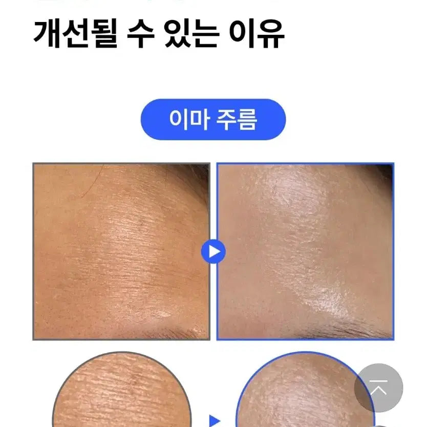 [BUNJANG] EGF FGF Collagen Serum / 피부과X한번만발라도 효과팔자 주름 기미탄력EGF FGF 콜라겐세럼