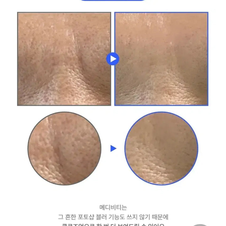 [BUNJANG] EGF FGF Collagen Serum / 피부과X한번만발라도 효과팔자 주름 기미탄력EGF FGF 콜라겐세럼