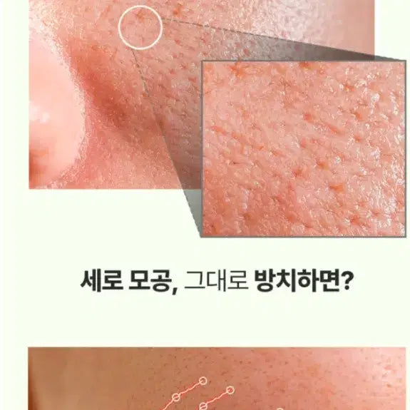 [BUNJANG] Green Tomato Pore Ampoule 30ml + 30ml / 1등모공앰플 그린토마토 뷰티어워즈수상 모공효과 3중모공솔루션