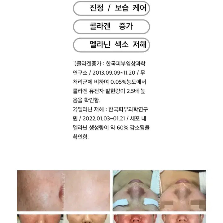 [SOLD OUT] 바이오폭스 텐지에프 리버스에이징 퓨어 솔루션 5ml x 4개 (피부앰플)