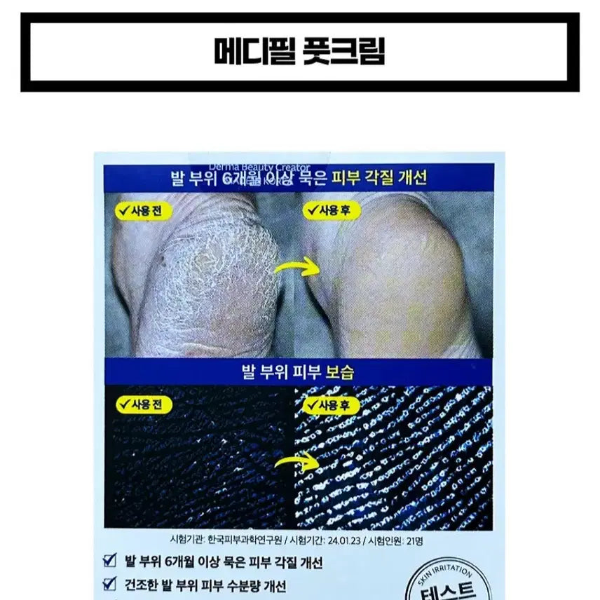 [BUNJANG] Medi-peel EGF Scaling Moisture Foot Cream / 메디필 EGF 스케일링 모이스처 풋 크림 130g(미개봉/새상품)
