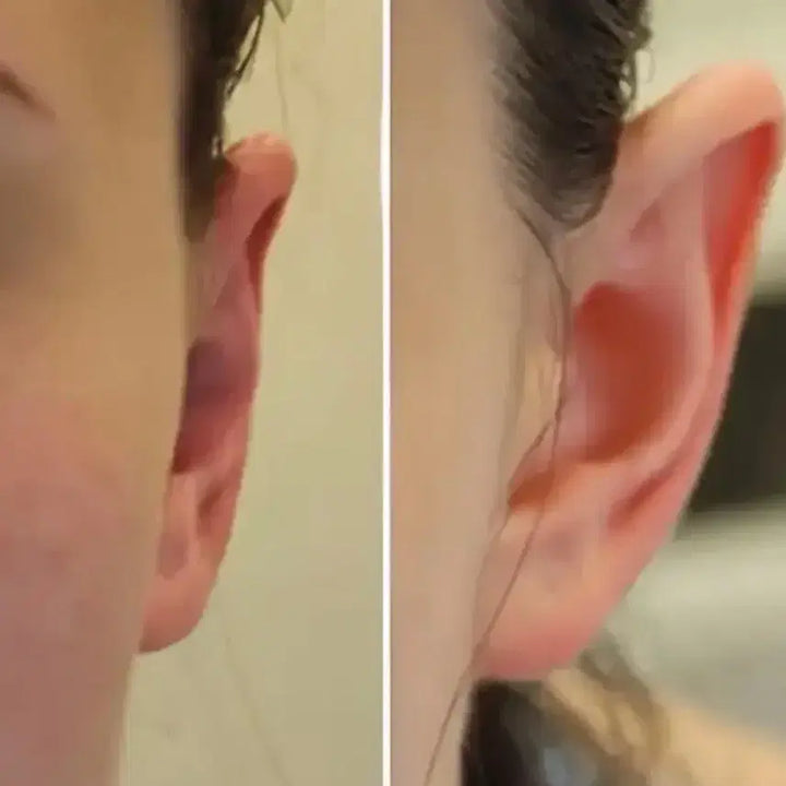 [BUNJANG] Elf Ear Correction Patch / 엘프귀 귀패치 귀패드 귀필러 귀교정 미용귀 얼굴 안면비대칭 얼굴축소