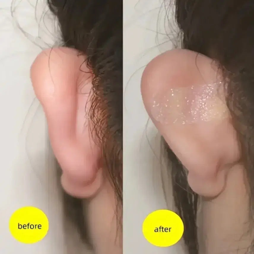 [BUNJANG] Elf Ear Correction Patch / 엘프귀 귀패치 귀패드 귀필러 귀교정 미용귀 얼굴 안면비대칭 얼굴축소