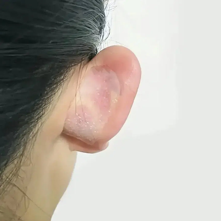 [BUNJANG] Elf Ear Correction Patch / 엘프귀 귀패치 귀패드 귀필러 귀교정 미용귀 얼굴 안면비대칭 얼굴축소