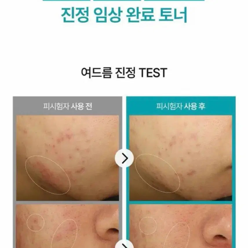 [BUNJANG] Heavblue Phyton Squalane Blue Toner 200ml / 헤브블루 피톤스쿠아히알블루토너 200ml