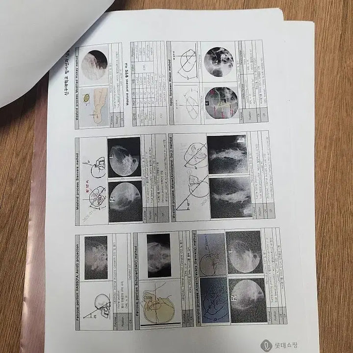 [BUNJANG] Radiation Technologist National Exam Study Guide & Summary / 방사선사 국가고시 이론.실기 문제집&전과목 써머리 판매