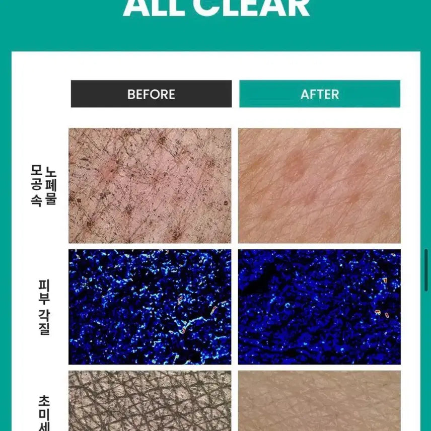 [BUNJANG] Dr.G Red Blemish Clear Soothing Foam 150ml - Sealed / (미개봉)닥터지(Dr.G) 레드 블레미쉬 클리어 수딩 폼 150ml