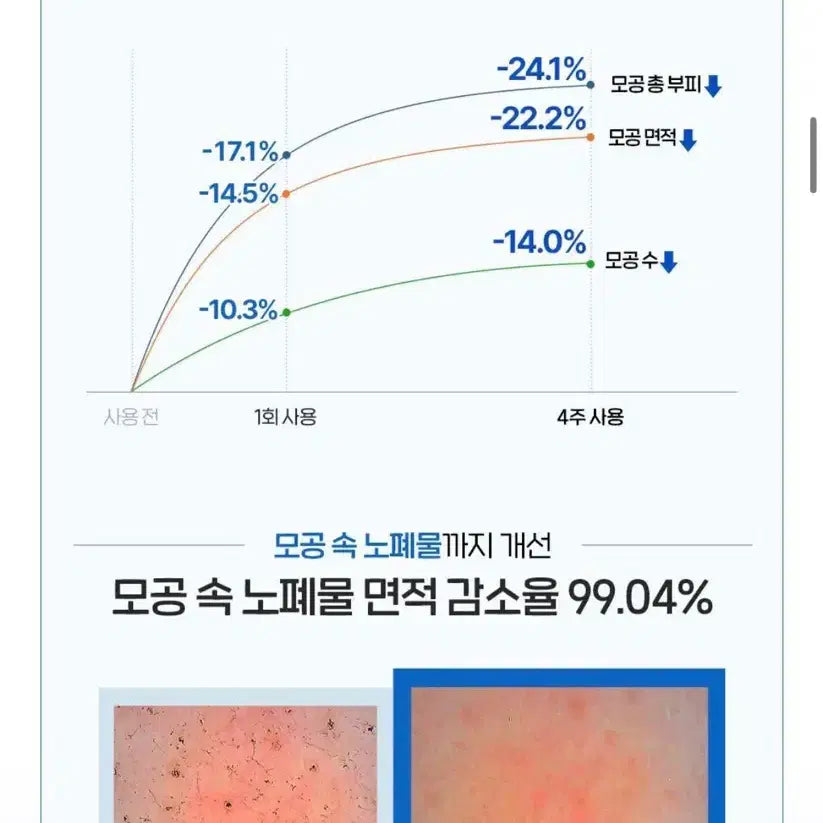 [BUNJANG] Pond's Pore Tightening Face Cleanser / 폰즈 팩 폼클렌징