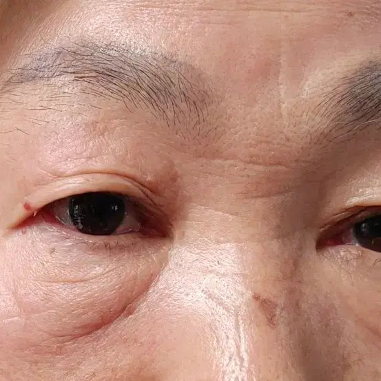 [SOLD OUT] 피부 관리하세요~